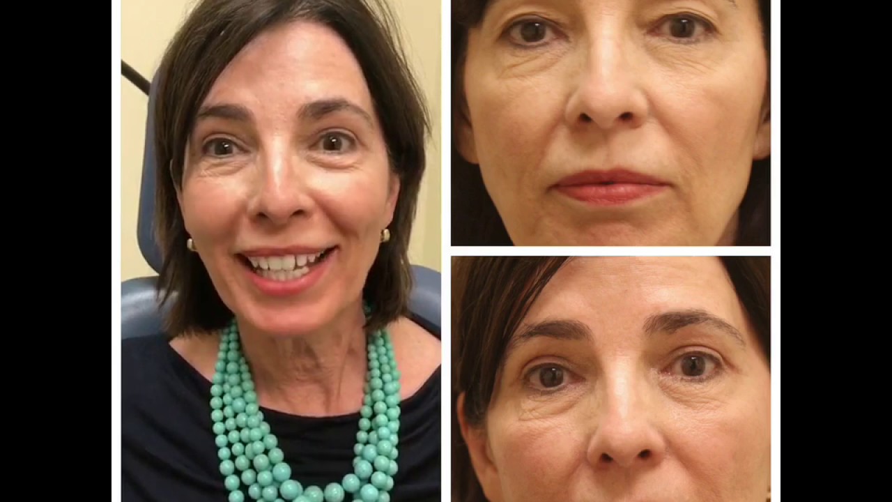 Smiling woman, close-up facial images and expressions.