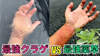 実践！クラゲに刺されたら「モンパノキ」という薬草が効くらしいけど本当？最強クラゲに刺されて塗ってみよう