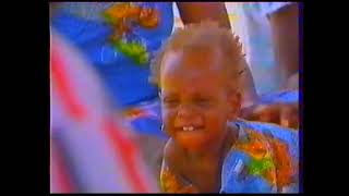 1994 - Noma, pathologie oubliée... Ouma, Ismael, Ramata, et les autres (Images pouvant heurter)