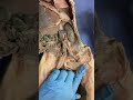 Human Anatomy: Arteries and Veins