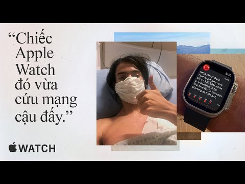 Thân gửi Apple | Apple Watch