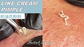 奶油花粉刺(Like Cream) - Taiwan Tainan台南清粉刺最乾淨
