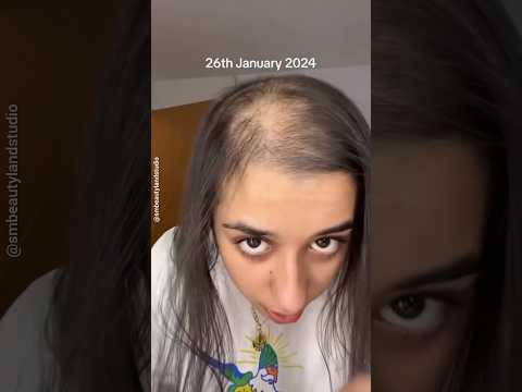 🔥Best Homemade Hair Oil For Extream Hair Fall😱✅ #shorts #smbeautylandstudio Smbeautylandstudio
