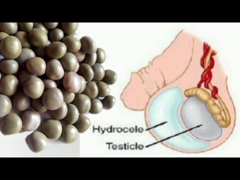 Hydrocele cure just in 4days with this home and old remedy||బుడ్డ వాపును తగ్గించే గఛ్చాముద పట్టు