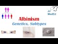 Exploring the Genetics and Types of Albinism
