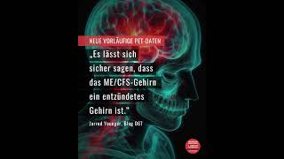 Younger et al: Erste PET-Daten zeigen Entzündungen im gesamten Gehirn von ME/CFS-Betroffenen