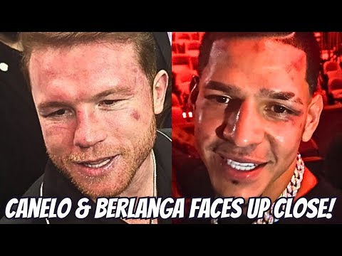 👀WHO LOOKS WORSE?👀 Saul Canelo Alvarez & Edgar Berlanga faces up close after their bout #canelo