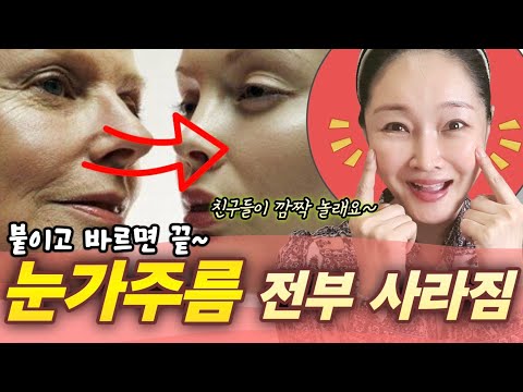 눈가주름 다림질! 주사 말고 이거하세요 금세 펴져요✔️