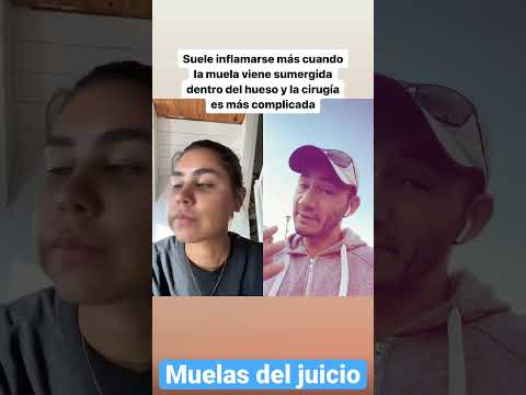 Cara inflamada después de muelas del juicio. ¿Es normal?