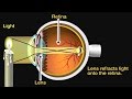Understanding Vision and Common Vision Problems