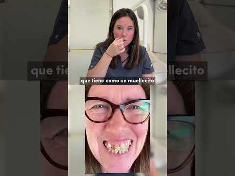 ¿Qué hacer cuando la boca está muy mal? 🤔