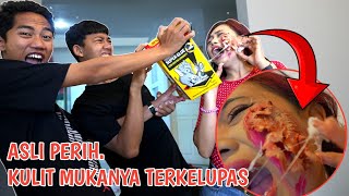 YA AMPUN WAJ4HNYA BIAN TIDAK SENGAJA KEN4 LEM TIKUS SAMPE JADI BEGINI??😱 | Mikael TubeHD