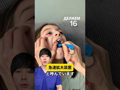 急速拡大装置について解説します
