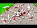 Bone Count and Injury Scenarios