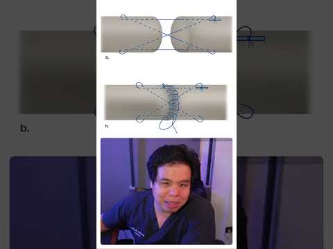 เอ็นขาด รักษายากไหม? #เป็นไรคลับ | PRCs 317 ความรู้สุขภาพใกล้ตัว