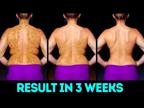 HOW TO BURN BACK FAT AND REVEAL A TONED, FIT BACK