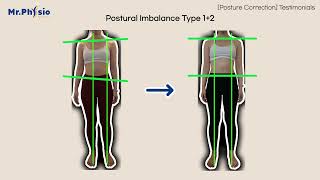 Postural correction exercises (Before & After + Testimonials)