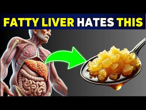 Top 10 Superfoods to Reverse Fatty Liver Naturally!