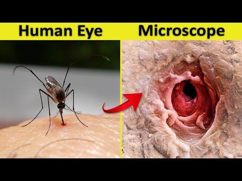 10 Things You Can See Only Under Microscope
