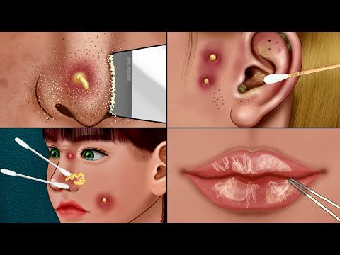 ASMR Very Satisfying Care Animation‼️ Piercing Cleaning, Nose Sebum, Lip Care, Make up