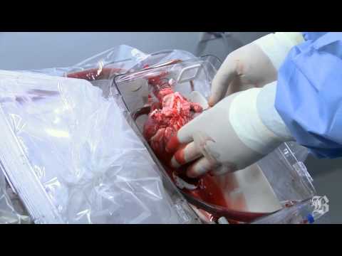 Device that keeps a donor heart beating