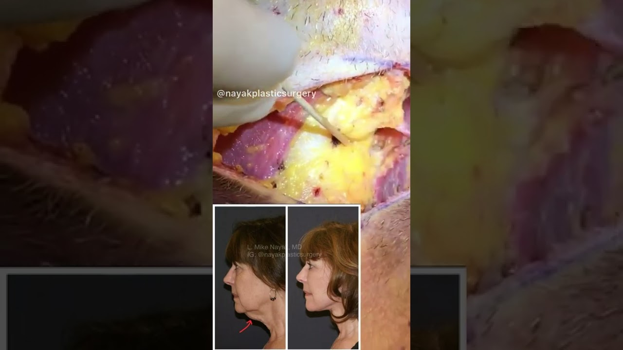 Surgical procedure before and after transformation.