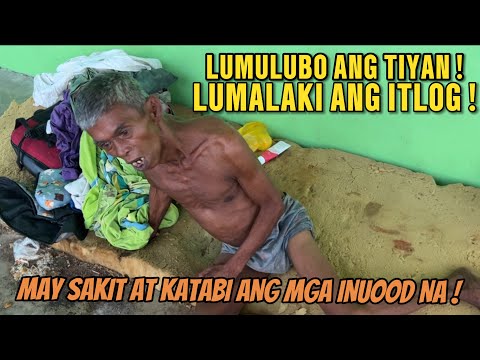 LUMALAKI ANG ITLOG AT MAY SAKIT NA SA ATAY ! DI MAN LANG DAW SIYA PUNTAHAN NG KAMAG ANAK !!