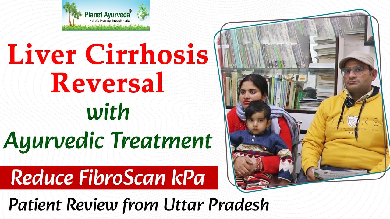 Watch Video Liver Cirrhosis Reversal with Ayurvedic Treatment, Reduce FibroScan kPa- Patient Review from UP