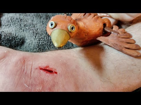 STUNG by a STINGRAY!!!