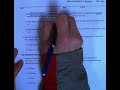 Understanding Absolute Values and Distances