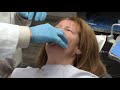 Bite Registration Techniques and Procedures