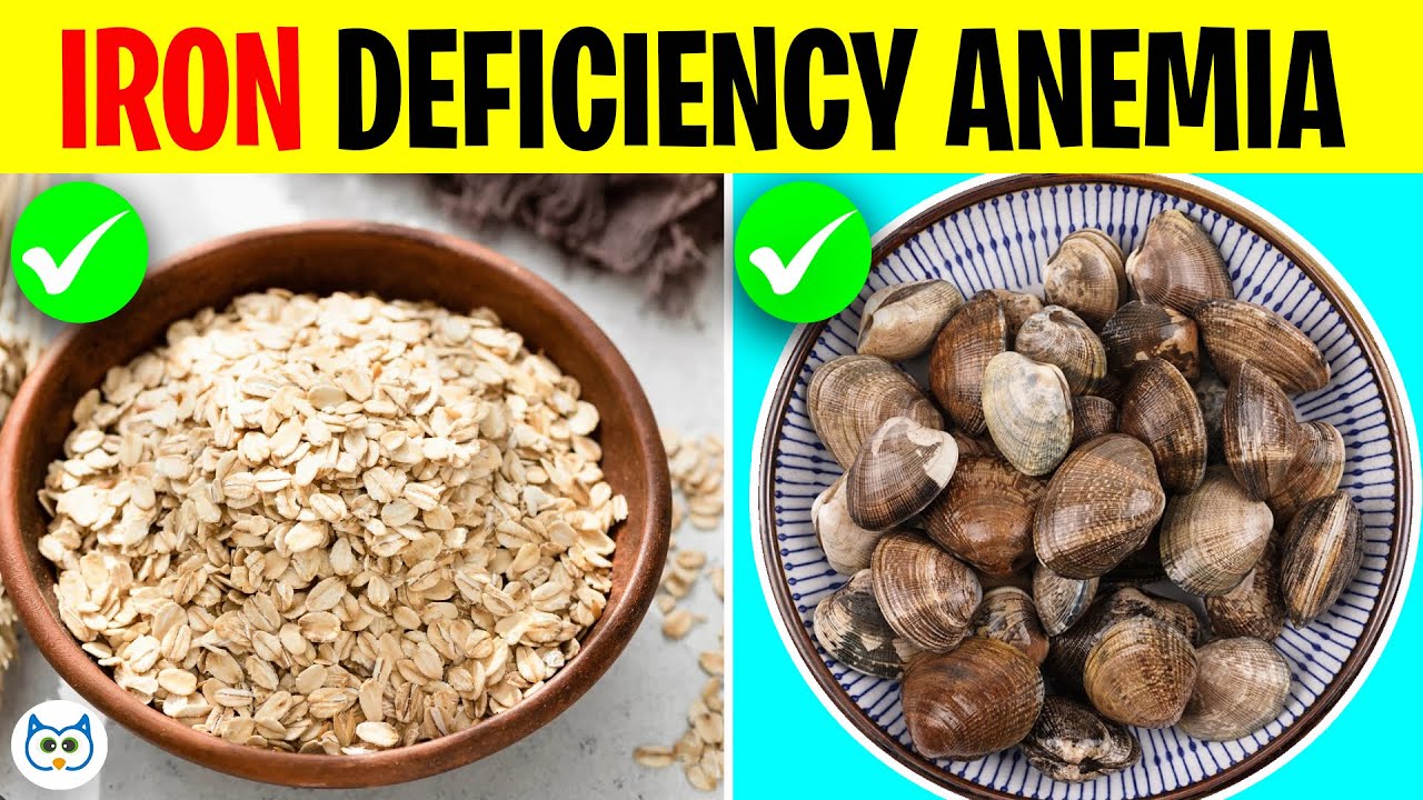 10 Best Foods for People with Iron Deficiency Anemia