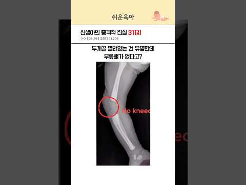 신생아에 대한 놀라운 사실 3가지