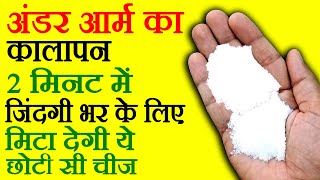अंडर आर्म का कालापन कैसे दूर करें - Kale Underarms Ko Gora Kaise Kare - How To Whiten Dark Underarms
