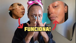 Como cuido da minha pele todas as manhãs (rotina simples e eficaz)