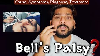 BELL'S PALSY: Symptoms, Treatment & Best Exercise | Facial Paralysis पूरी जानकारी के साथ मेरी कहानी