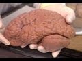 Understanding the Brain Bank and Brain Research