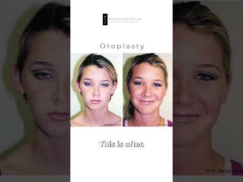 Dr. Grover on Ear Surgery