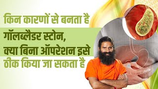 किन कारणों से बनता है Gallbladder Stone, क्या बिना ऑपरेशन इसे ठीक किया जा सकता है || Swami Ramdev