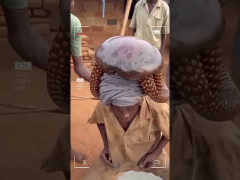 This Kinshasha teenager went swimming in the river and came out with a creature attached to his head