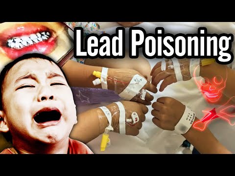 200+ kids suffer lead poisoning in China