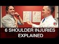 Diagnosing Common Shoulder Injuries