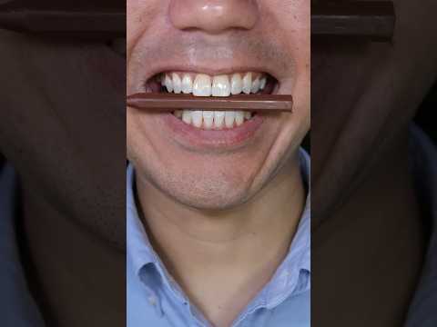 Nobel Super Soda Candy ASMR#shots