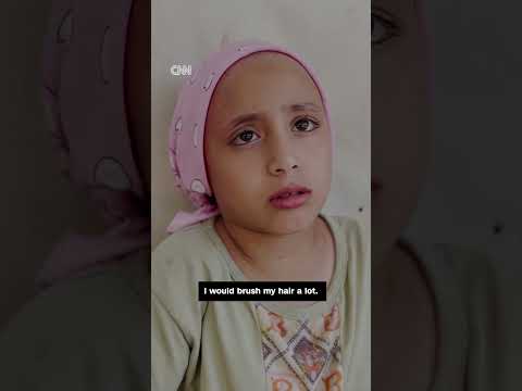 Doctors say war in Gaza led to child's hair loss