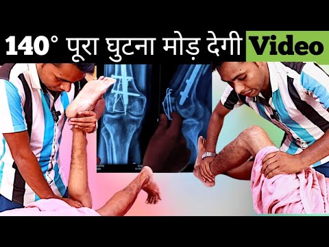 knee bending exercises after surgery in hindi, how to cure knee stiffness, jaam ghatna kaise mode