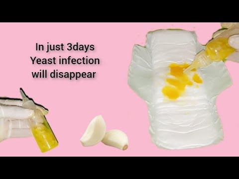 Powerful natural remedy to get rid of vaginal yeast infection in just 3 days