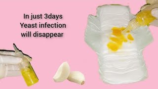 Powerful natural remedy to get rid of vaginal yeast infection in just 3 days