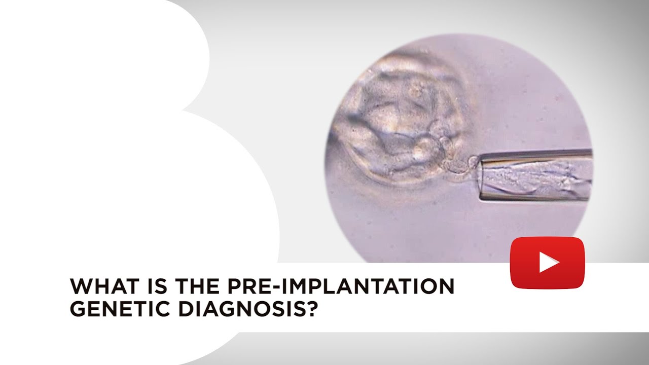 Pre-implantation genetic diagnosis (PDG)