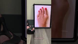 WILL I BE ABLE TO WEAR HIGH HEELS AFTER SURGERY?👠#shorts #highheels