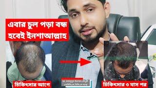 এবার চুল পড়া বন্ধ হবেই। চুল পড়া কমানোর উপায়। How to reduce hairfall? Dr Mahamudul Islam Chowdhury